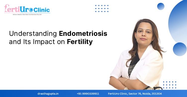 Understanding Endometriosis and Its Impact on Fertility